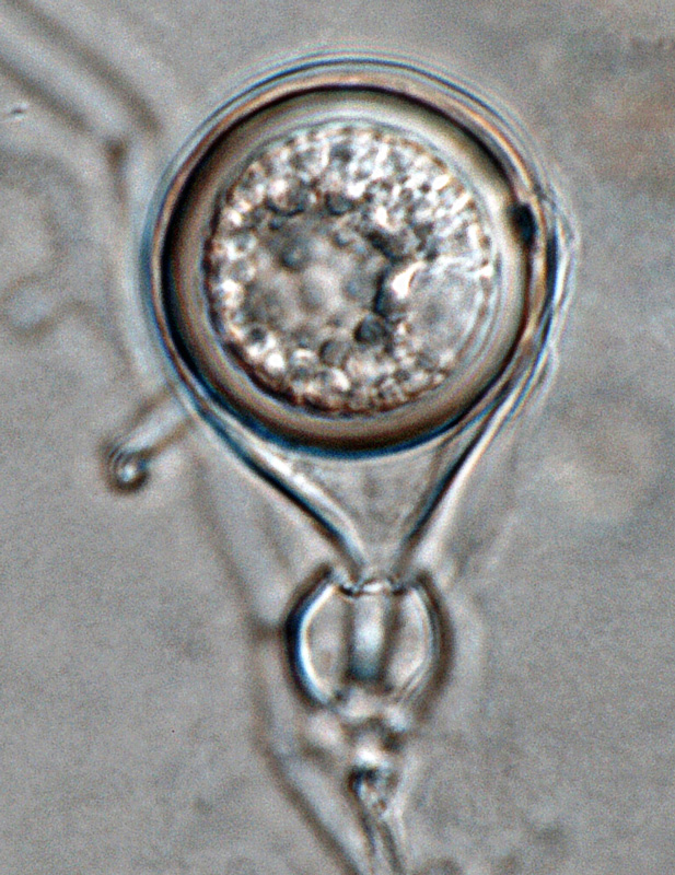   Phytophthora heveae nbsp;(P10167, selected specimen) homothallic sexual phase: smooth-walled oogoniumnbsp;with tapered base; amphigynous antheridiumnbsp;and aplerotic oospore; photo by Gloria Abad, USDA-APHIS-PPQ. 
