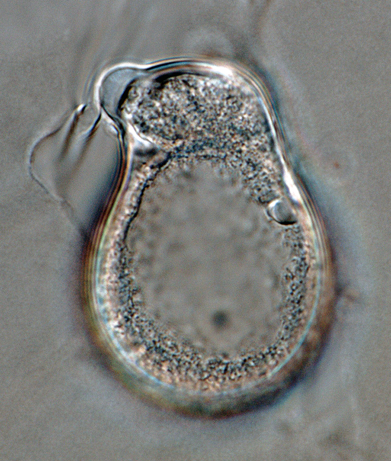   Phytophthora boehmeriae nbsp;(CPHST BL 32G ex-type) asexual phase: sporangium with irregular shape, papillate, caducous.nbsp;Photo by Gloria Abad, USDA-APHIS-PPQ. 
