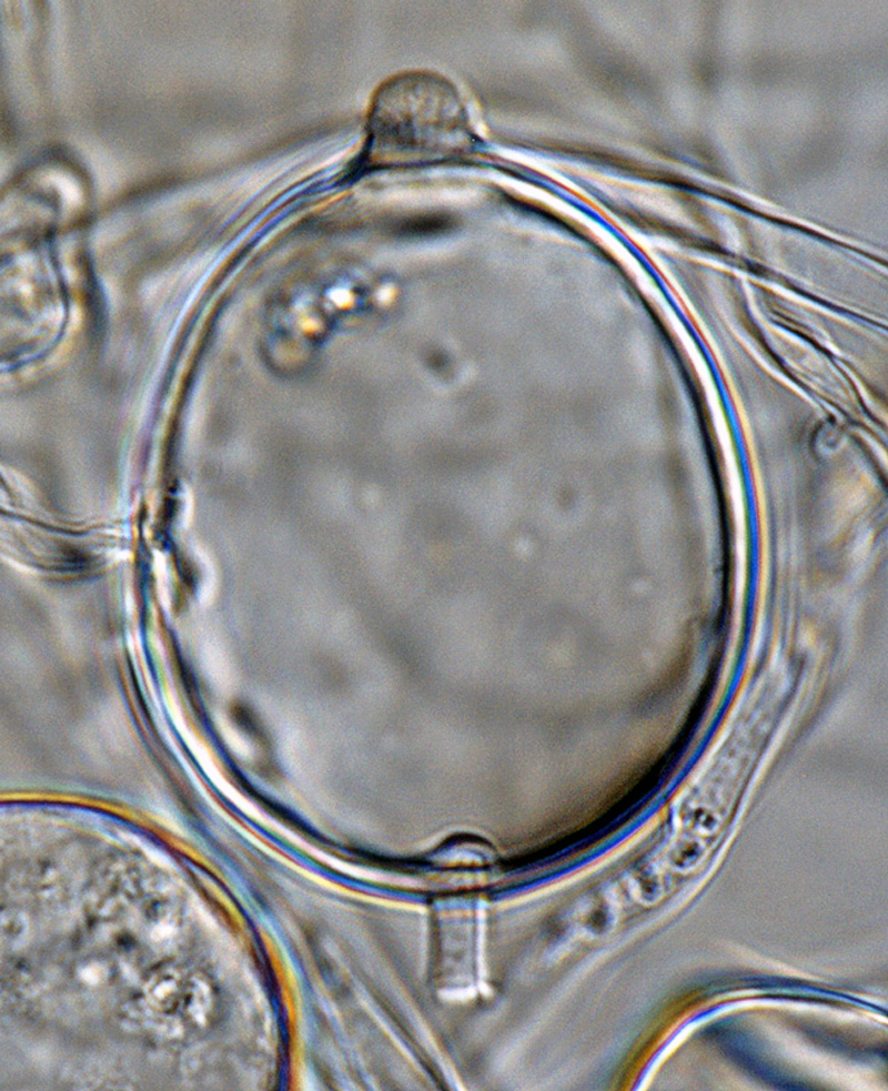   Phytophthora boehmeriae nbsp;(CPHST BL 32G ex-type) asexual phase: sporangium globose, papillate, caducous, with short pedicel.nbsp;Photo by Gloria Abad, USDA-APHIS-PPQ. 

