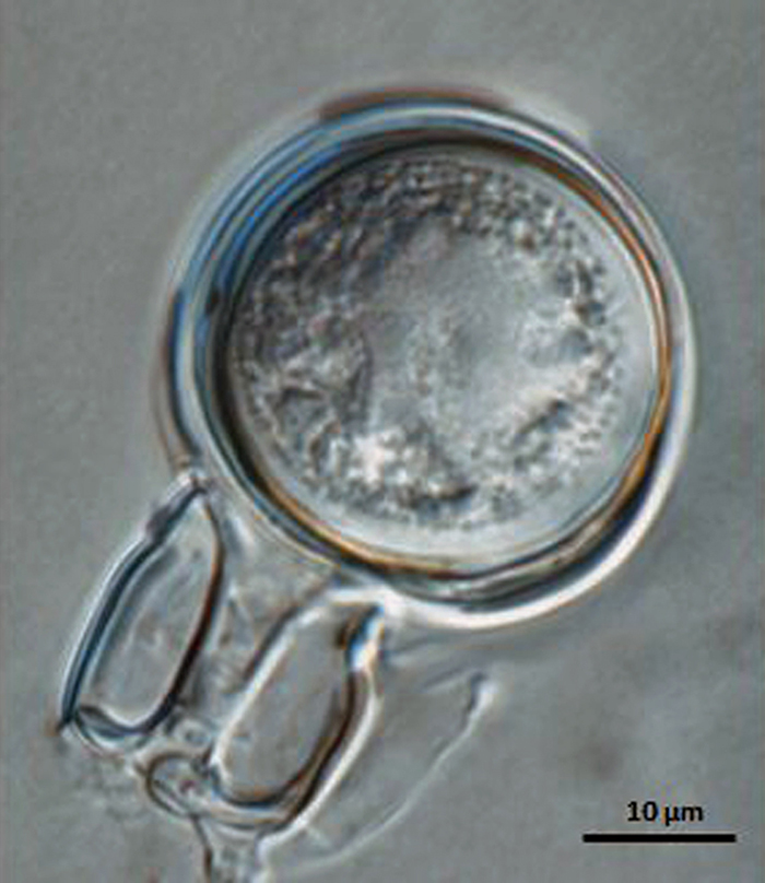   Phytophthora boehmeriae nbsp;(CPHST BL 32G ex-type) sexual phase: oogonium smooth-walled with amphigynous antheridium almost spherical in shapenbsp;withnbsp;plerotic oospore. Photo by Gloria Abad, USDA-APHIS-PPQ. 
