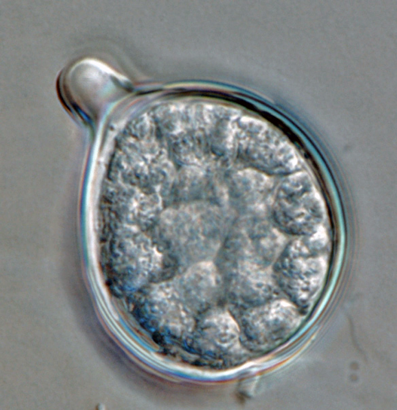   Phytophthora boehmeriae nbsp;(CPHST BL 32G ex-type) asexual phase: sporangium globose, papillate, caducous, with short pedicel.nbsp;Photo by Gloria Abad, USDA-APHIS-PPQ. 
