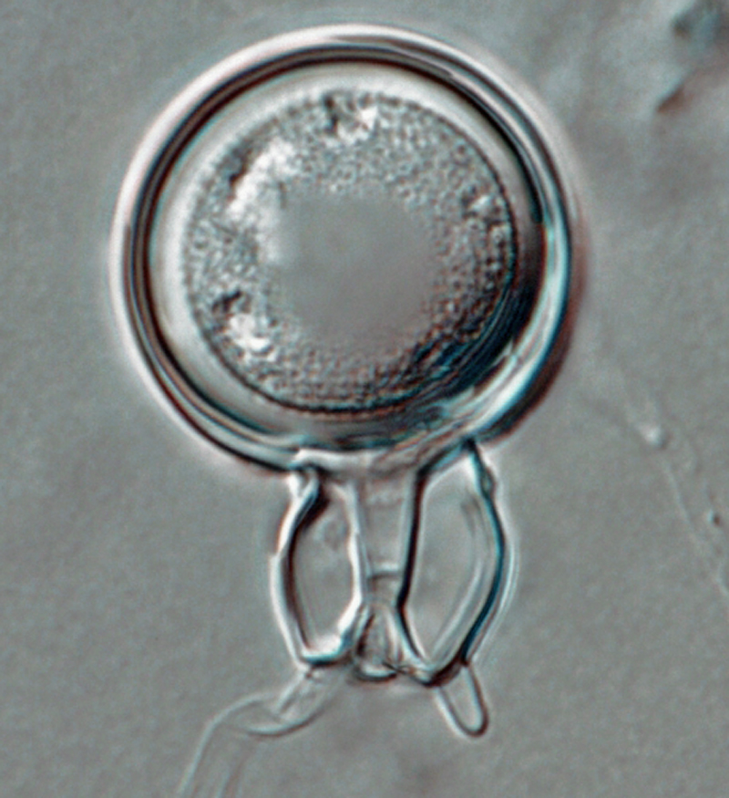   Phytophthora boehmeriae nbsp;(CPHST BL 32G ex-type) sexual phase: oogonium smooth-walled with amphigynous antheridium almost spherical in shapenbsp;withnbsp;plerotic oospore. Notenbsp;digitated projection on antheridium. Photonbsp;by Gloria Abad, USDA-APHIS-PPQ. 
