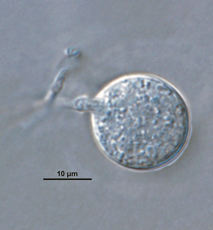   Phytophthora brassicae nbsp;ex-type CPHST BL 8, asexual phase: globose sporangium (chlamydospores absent in species).nbsp;Photo by G. Abad, USDA-APHIS-PPQ. 
