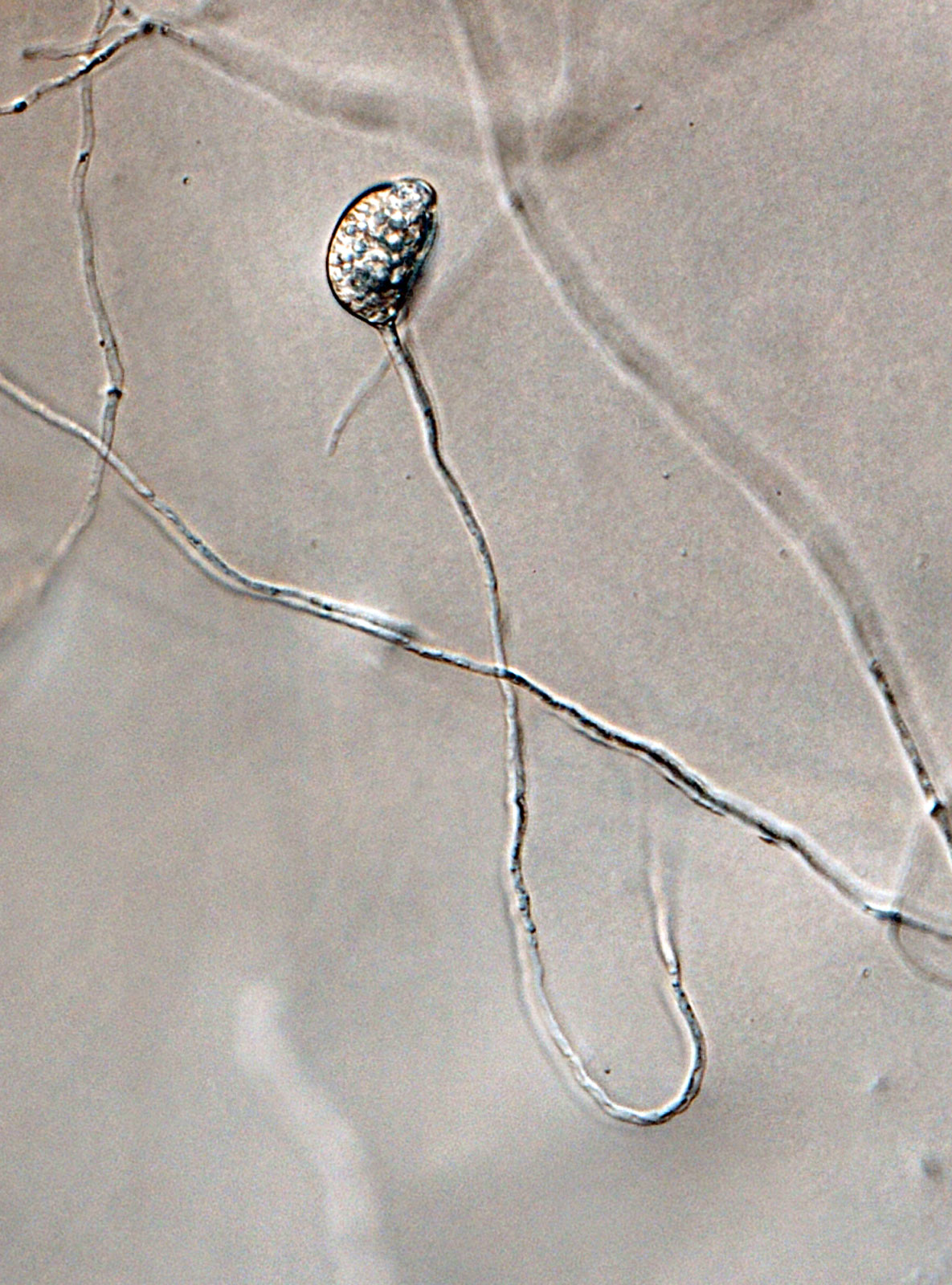   Phytophthora brassicae nbsp;ex-type CPHST BL 8, asexual phase: sporangia produced in sporangiophore. Photo by G. Abad, USDA-APHIS-PPQ. 
