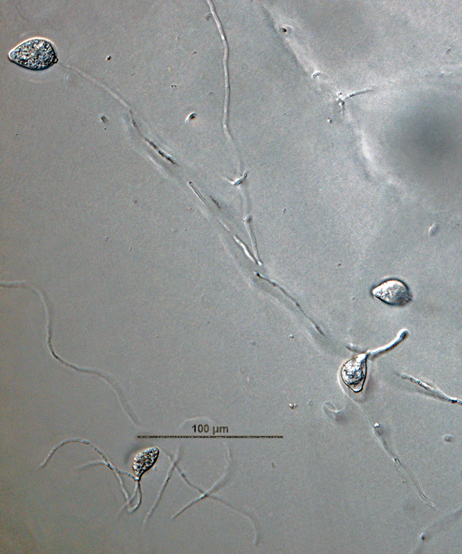   Phytophthora brassicae nbsp;ex-type CPHST BL 8, asexual phase: sporangia produced in sporangiophores.nbsp;Photo by G. Abad, USDA-APHIS-PPQ. 

