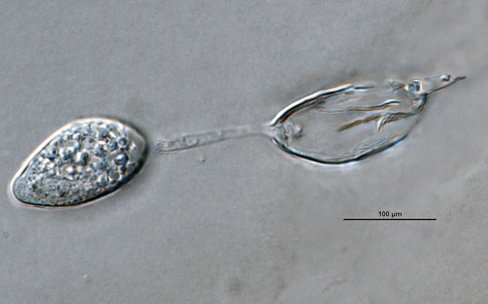   Phytophthora brassicae nbsp;ex-type CPHST BL 8, asexual phase: sporangium with external proliferation. Photo by G. Abad, USDA-APHIS-PPQ. 
