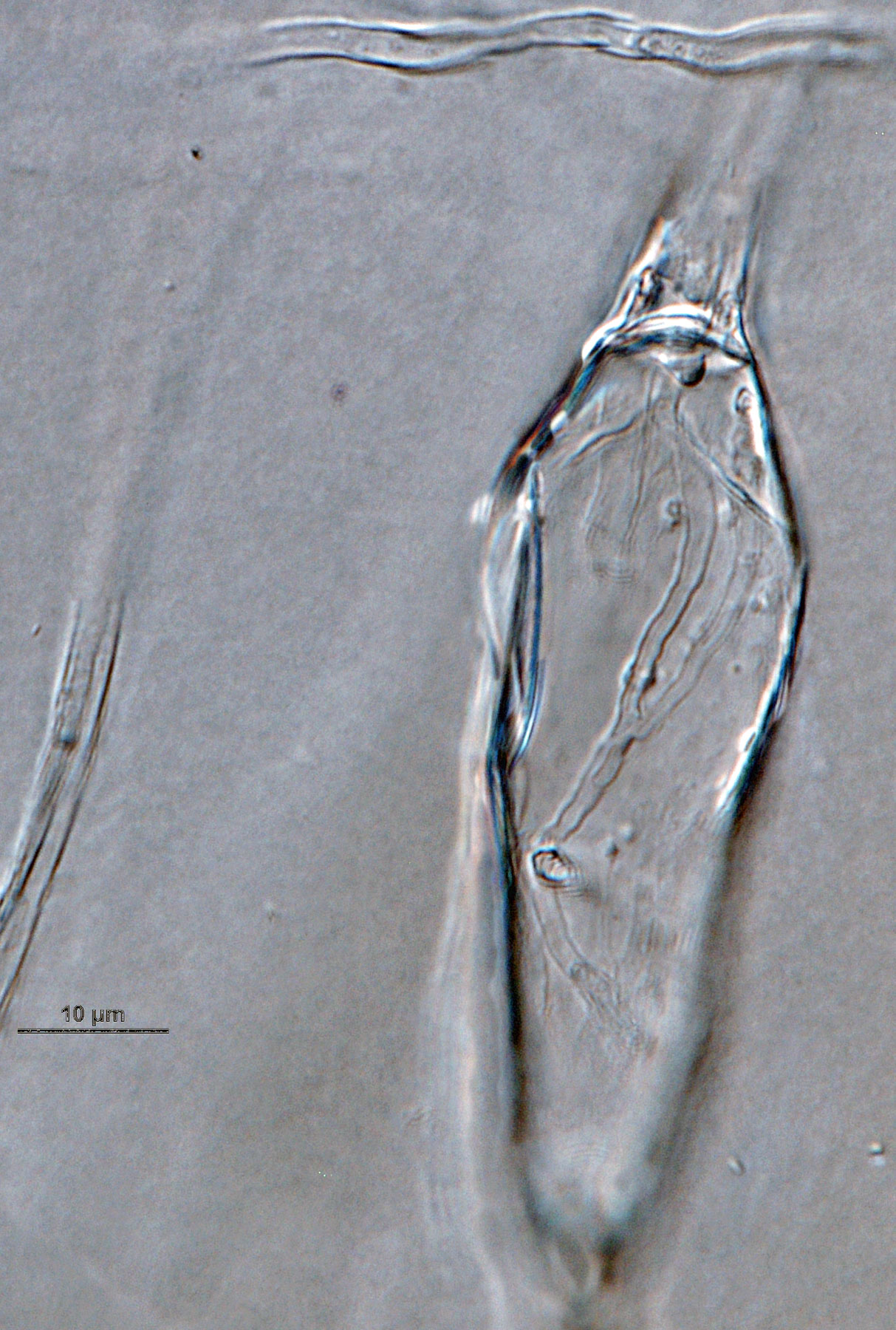   Phytophthora brassicae nbsp;ex-type CPHST BL 8, asexual phase: sporangium with internal proliferation. Photo by G. Abad, USDA-APHIS-PPQ. 
