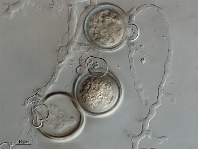   Phytophthora cactorum nbsp;(CPHST BL 9) sexual phase formed on V8 agar flooded with soil extract: three oogonia with paragynous antheridia, in bottom abortive oogonium.nbsp;Photo by V. Brewster, USDA-APHIS-PPQ. 
