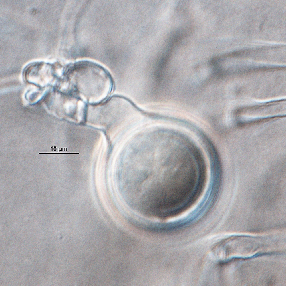   Phytophthora cactorum nbsp;(CPHST BL 9) sexual phase formed on V8 agar flooded with soil extract: plerotic oospore in smooth wall oogonium with tapered base and paragynous antheridium. Photo by G. Abad, USDA-APHIS-PPQ. 
