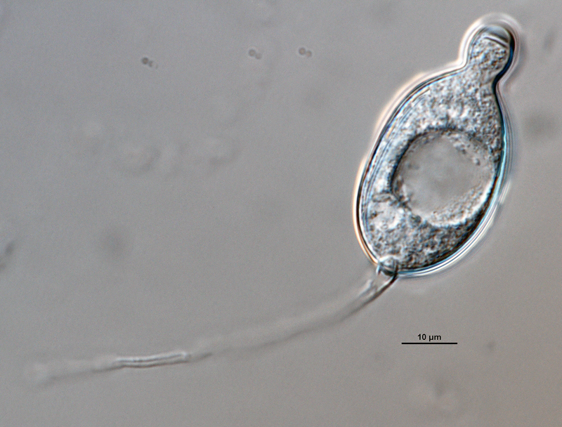   P. capsici nbsp;(ex-type CPHST BL 33) asexual phase: semipapillate distorted shape sporangium with long pedicel; photo by Gloria Abad, USDA-APHIS-PPQ. 
