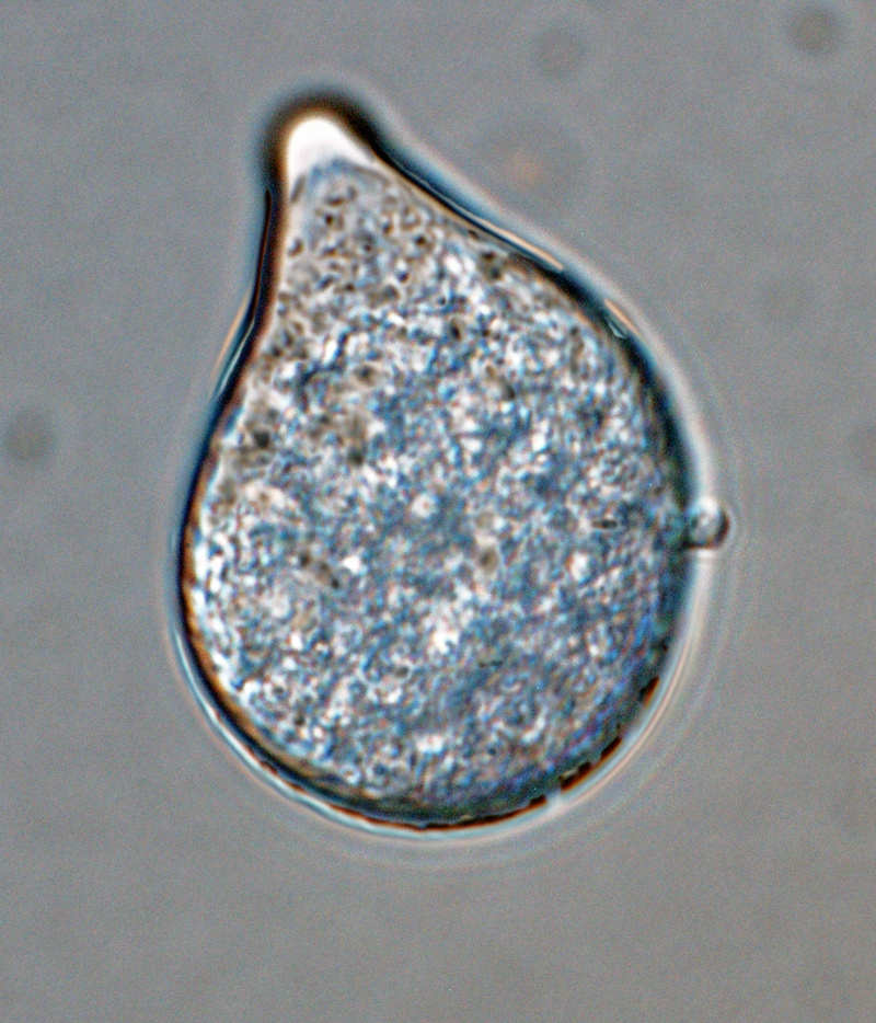   P. capsici nbsp;(ex-type CPHST BL 33) asexual phase: papillate subglobose sporangium with short pedicel; photo by Gloria Abad, USDA-APHIS-PPQ. 
