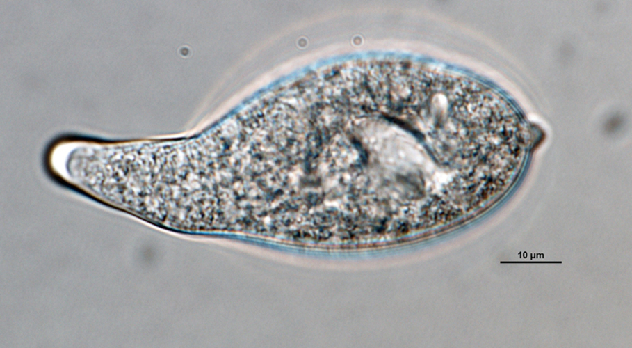   P. capsici nbsp;(ex-type CPHST BL 33) asexual phase: semipapillate pyriform sporangium with medium pedicel; photo by Gloria Abad, USDA-APHIS-PPQ. 
