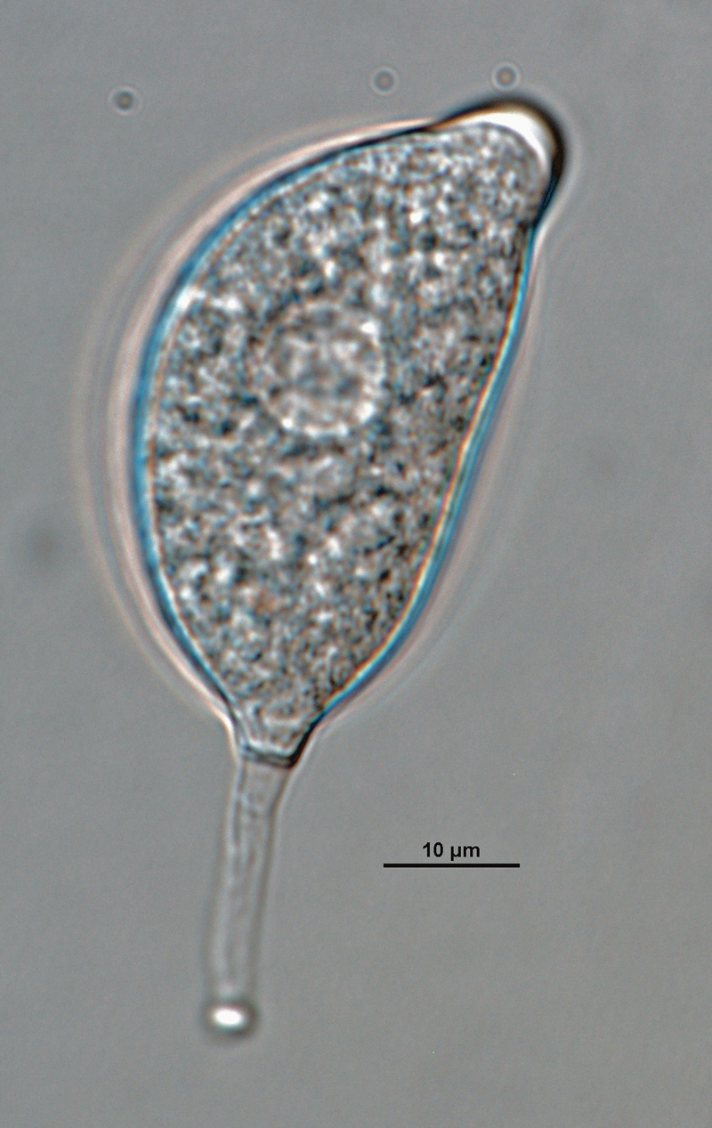   P. capsici nbsp;(ex-type CPHST BL 33) asexual phase: semipapillate distorted shape sporangium with medium pedicel; photo by Gloria Abad, USDA-APHIS-PPQ. 
