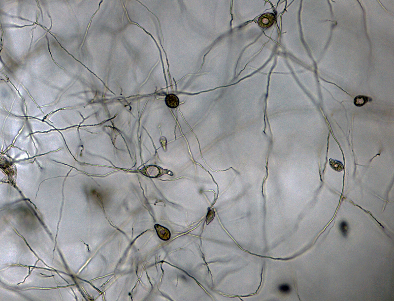   P. capsici nbsp;(ex-type CPHST BL 33) asexual phase:nbsp;sporangia formed in unbranched and irregular branched sporangiophores; photo by Gloria Abad, USDA-APHIS-PPQ. 
