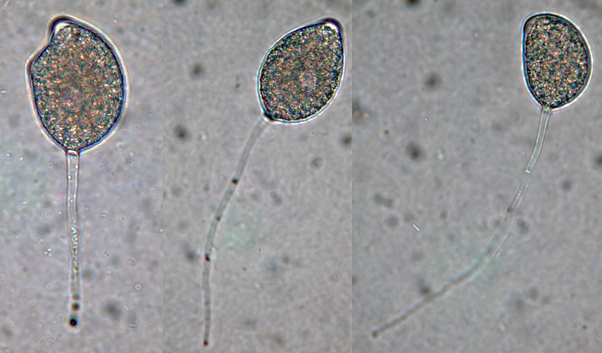   Phytophthora capsici nbsp;(selected specimen P223) asexual phase: semipapillate variably shaped caducous sporangia with long pedicels;nbsp;photo by Gloria Abad, USDA-APHIS-PPQ. 
