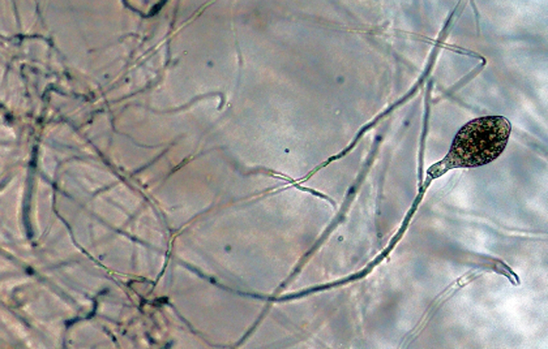   Phytophthora fragariaefolia  (ex-type CPHST BL 141) asexual phase with nonpapillated persistent sporangia originated in unbranched sporangiophore; photo by Gloria Abad, USDA-APHIS-PPQ. 
