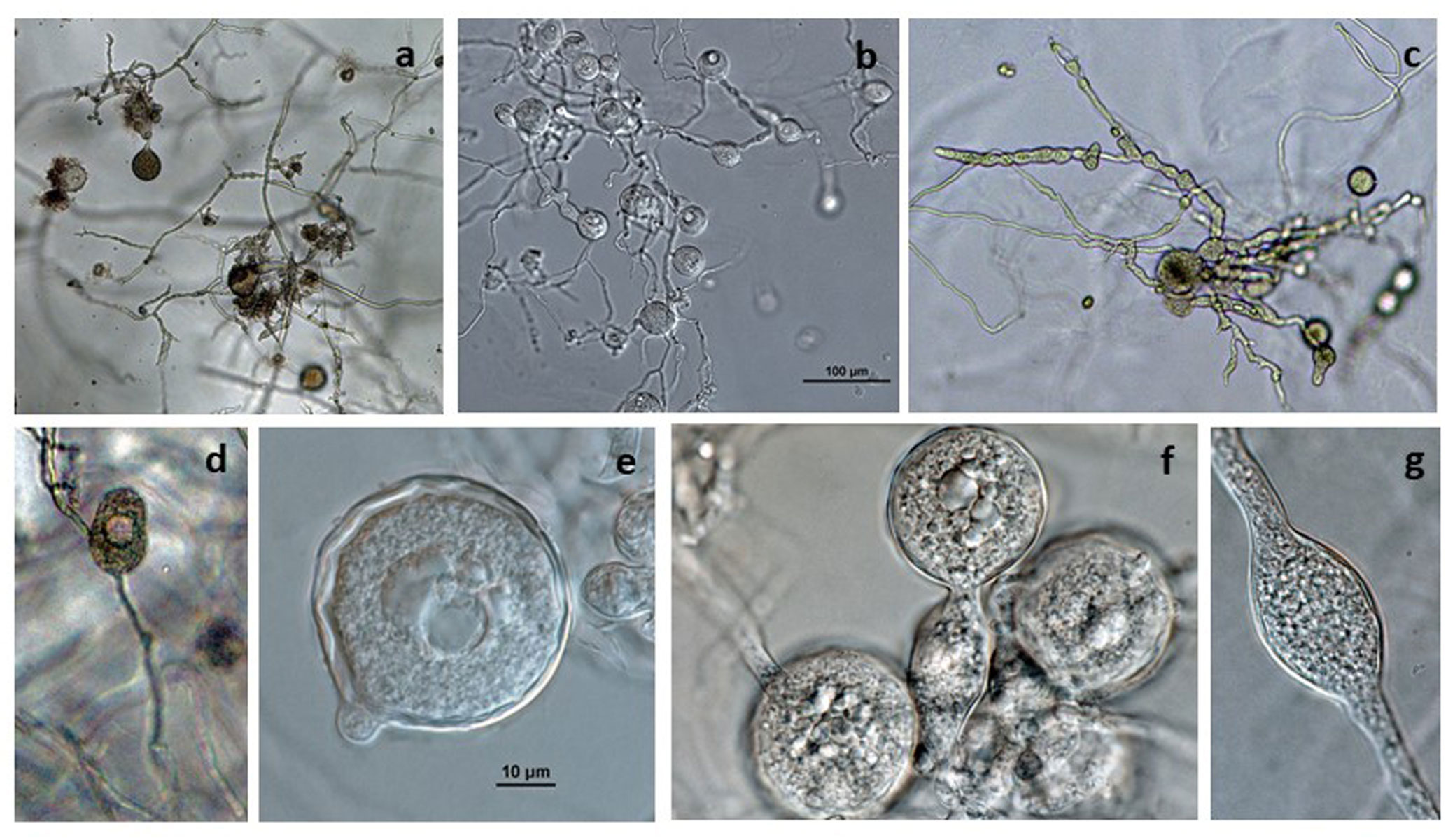   Phytophthora gallica  (CPHST BL 35) asexual phase of the ex-type producing chlamydosporesnbsp;and hyphal swellings, and (d) nonpapillate persistent sporangium; photos by Gloria Abad USDA-APHIS-PPQ. 
