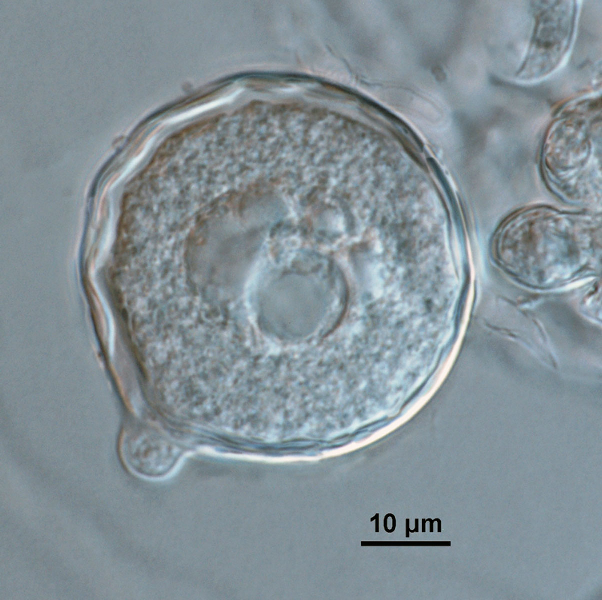   Phytophthora gallica  (CPHST BL 35) asexual phase of the ex-type: chlamydospore; photo by Gloria Abad USDA-APHIS-PPQ. 
