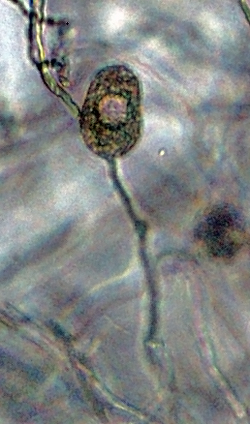   Phytophthora gallica  (CPHST BL 35) asexual phase of the ex-type producing a nonpapillate persistent sporangium; photo by Gloria Abad USDA-APHIS-PPQ. 
