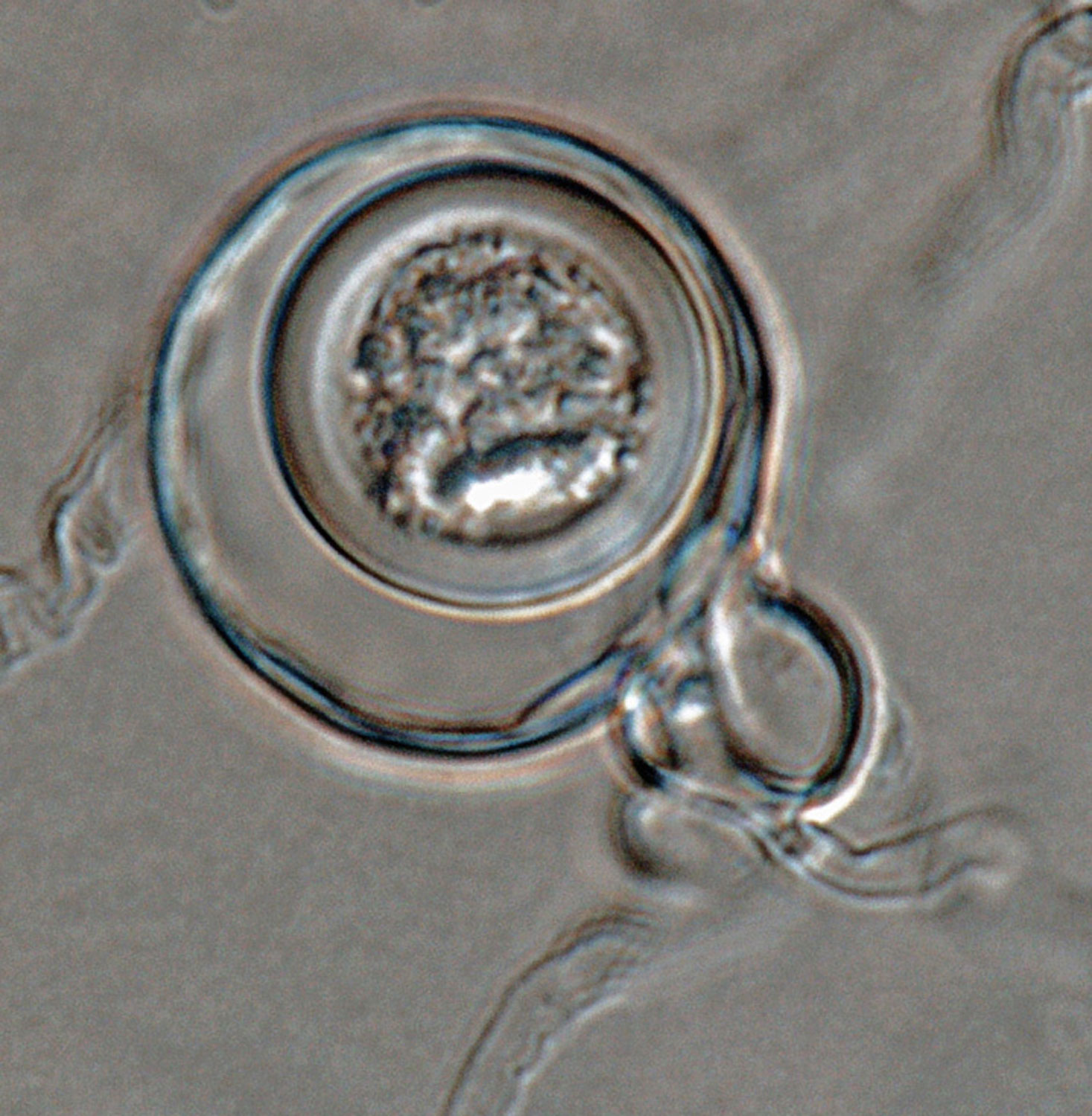   Phytophthora glovera nbsp;(CPHST BL 36) sexual phase of the ex-type: smooth oogoniumnbsp;with aplerotic oosporenbsp;andnbsp;amphigynousnbsp;antheridium; photo by Gloria Abad, USDA-APHIS-PPQ. 
