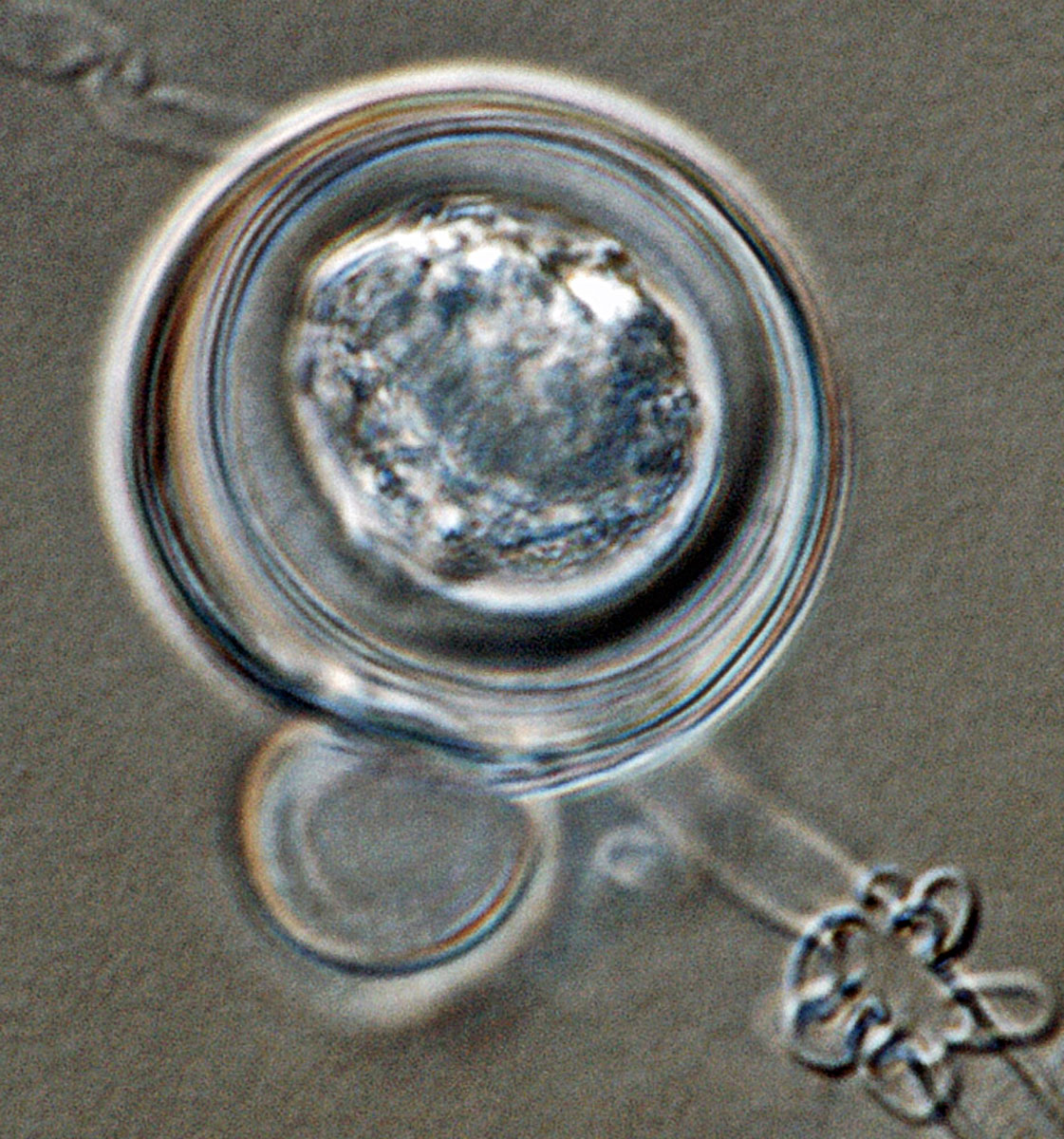   Phytophthora glovera  (CPHST BL 36) sexual phase of the ex-type: smooth oogonium with aplerotic oospore, with paragynous antheridium; photo by Gloria Abad, USDA-APHIS-PPQ. 
