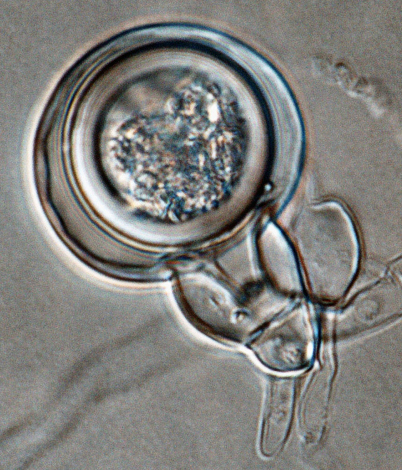   Phytophthora glovera nbsp;(CPHST BL 36) sexual phase of the ex-type: smooth oogoniumnbsp;with aplerotic oosporenbsp;andnbsp;amphigynousnbsp;antheridium with finger-like projections; photo by Gloria Abad, USDA-APHIS-PPQ. 
