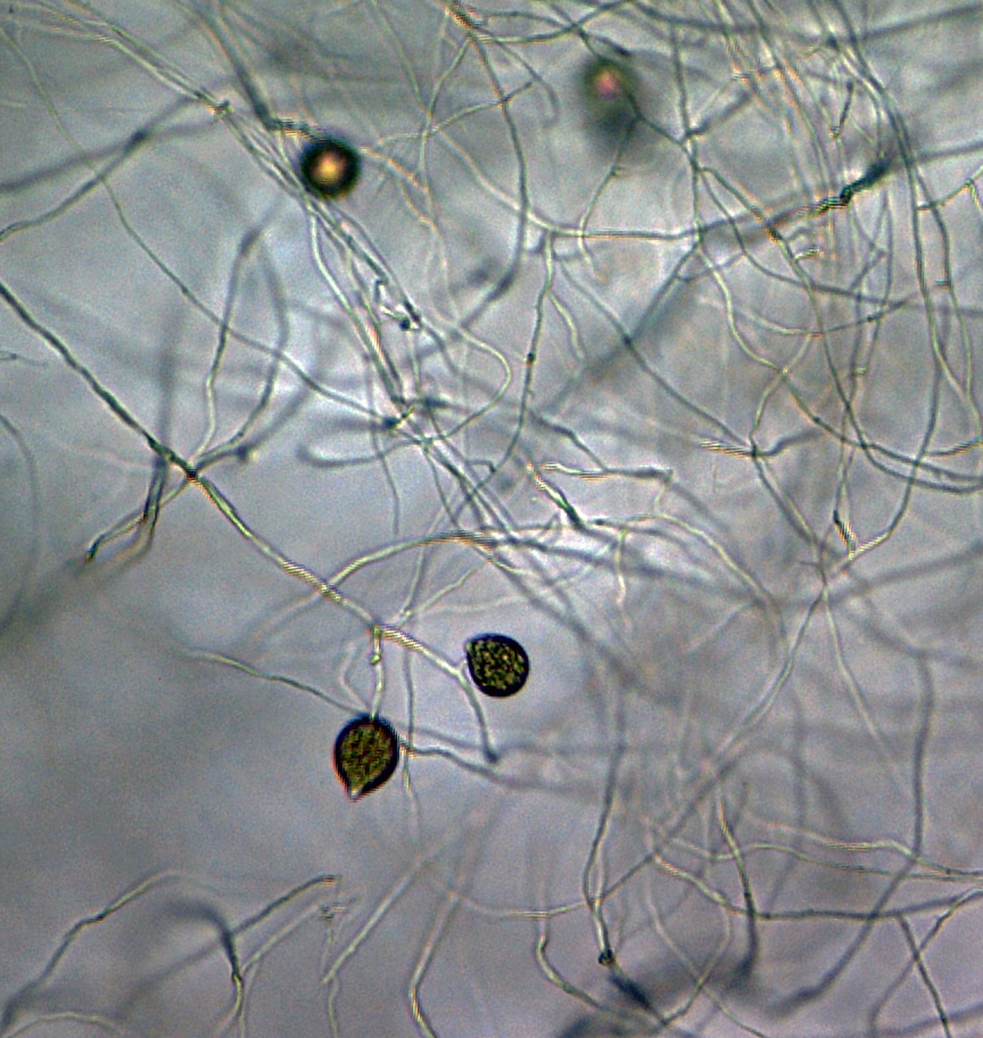   Phytophthora glovera nbsp;(CPHST BL 36) asexual phase of the ex-type: sporangia produced in simple sympodial sporangiphores; photo by Gloria Abad, USDA-APHIS-PPQ. 

