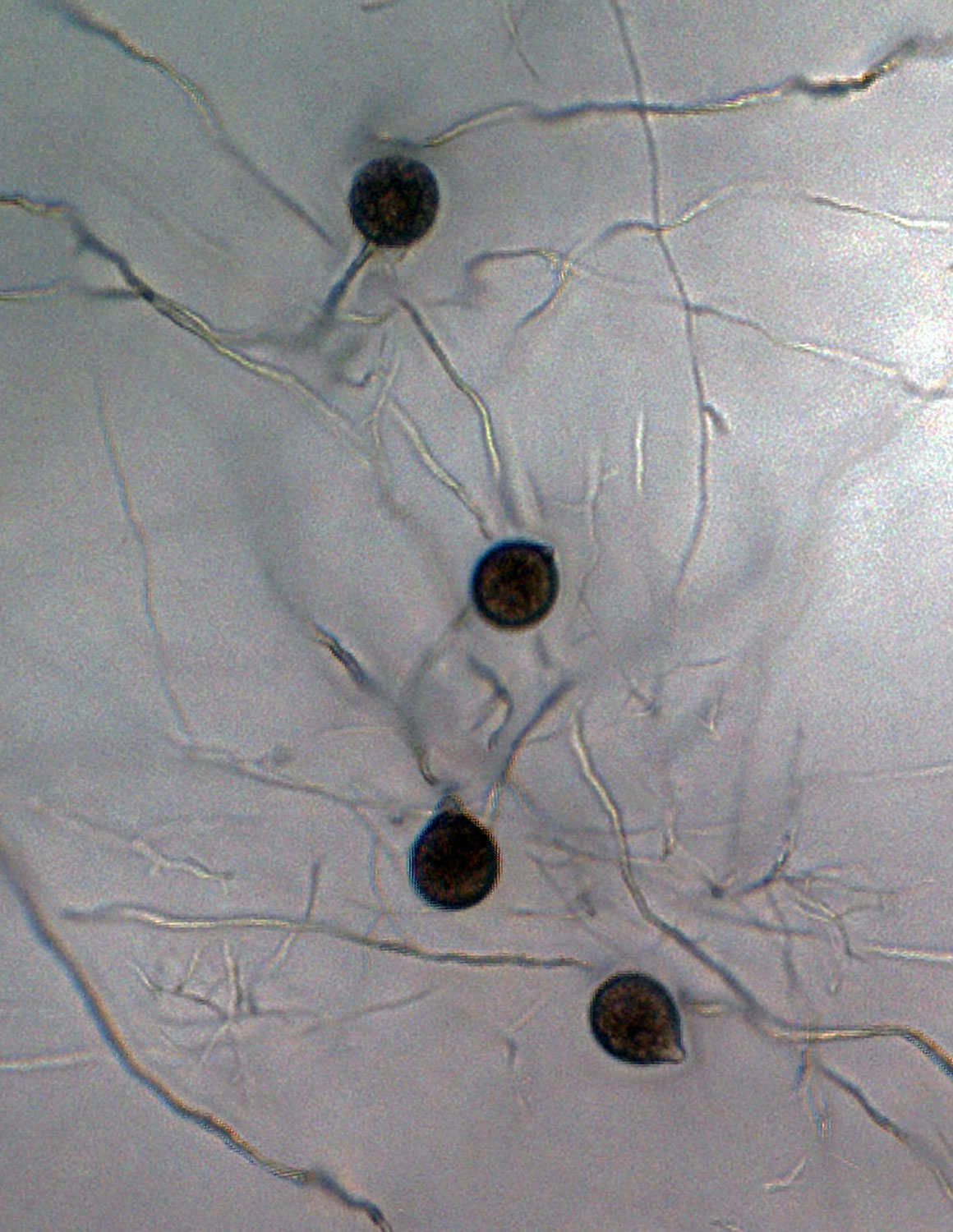   Phytophthora glovera nbsp;(CPHST BL 36) asexual phase of the ex-type: sporangia produced in simple sympodial sporangiphores; photo by Gloria Abad, USDA-APHIS-PPQ. 
