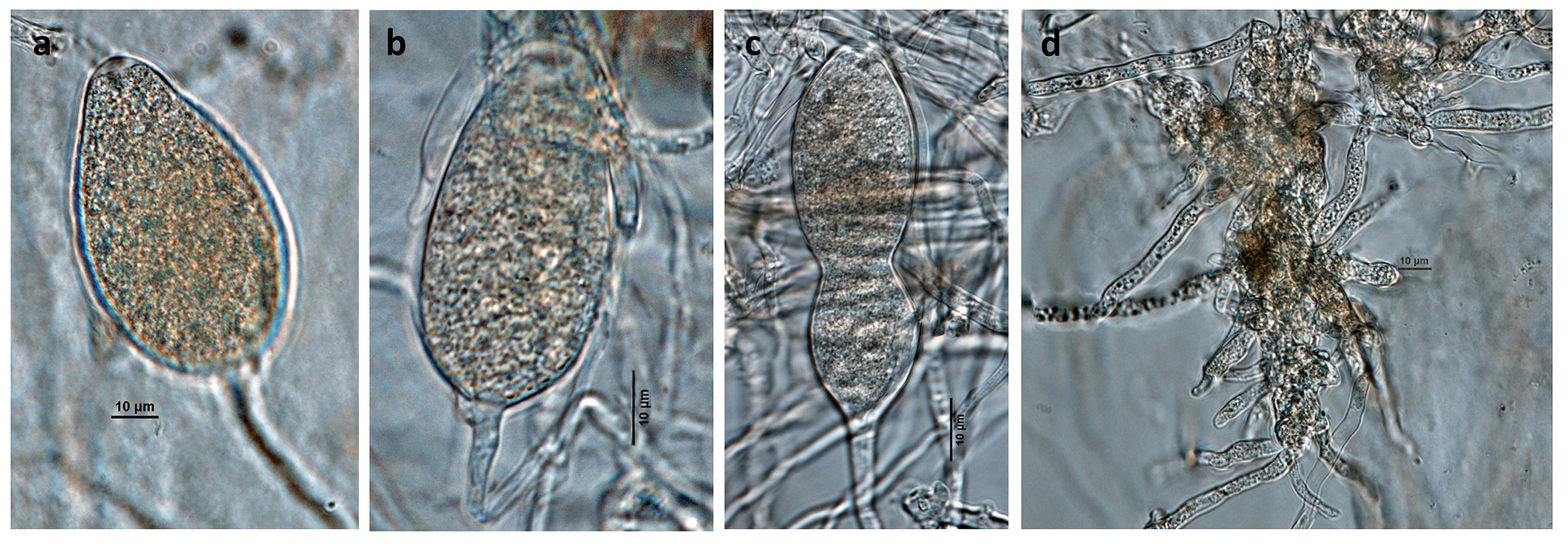   Phytophthora gonapodyides nbsp;(CPHST BL 172, selected specimen) asexual phase: (andash;c) nonpapillated sporangia produced in unbranched sporangiophores; (d) radiating hyphae; photos by Gloria Abad, USDA-APHIS-PPQ. 
