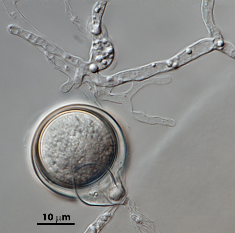   Phytophthora hedriandranbsp; (CPHST BL 4) sexual phase of the ex-type: smooth oogonium with paragynous antheridium and aplerotic oospore; photo by Gloria Abad, USDA-APHIS-PPQ. 
