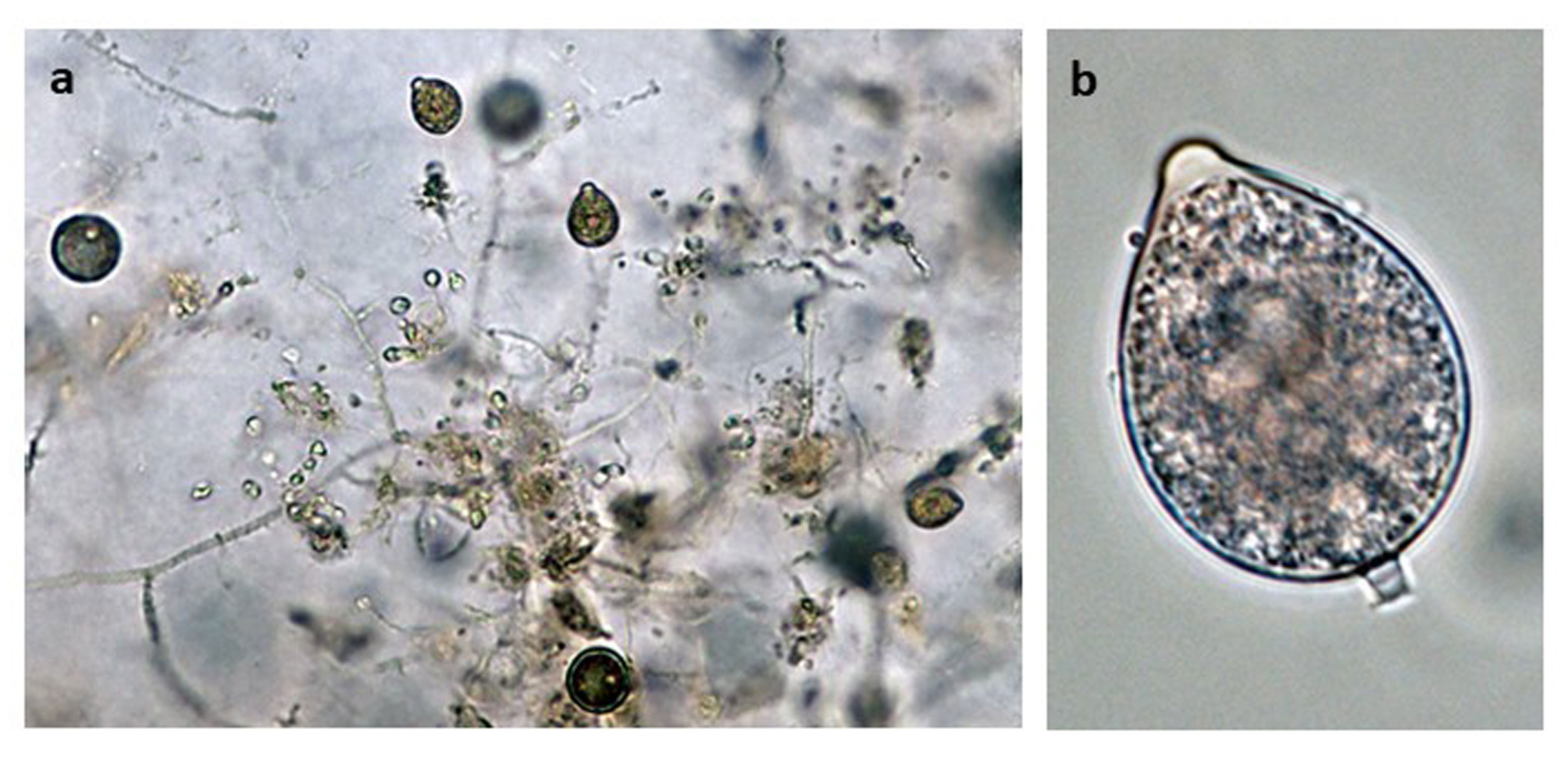   Phytophthora hedriandra  (CPHST BL 4) asexual phase of the ex-type: (a) sporangianbsp;and oospores, (b) sporangium papillate with caducous short pedicel; photos by Gloria Abad USDA-APHIS-PPQ. 
