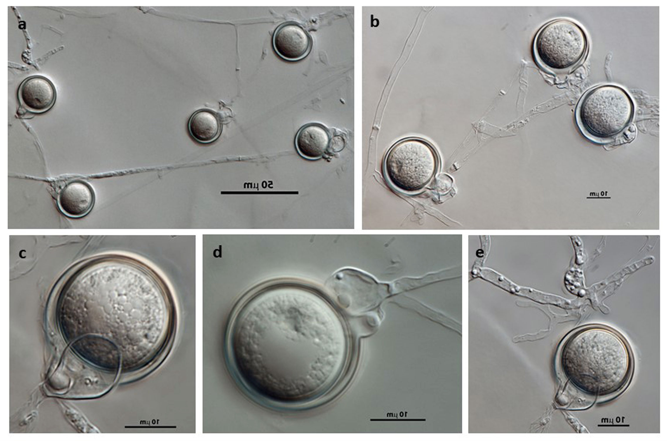   Phytophthora hedriandra  (CPHST BL 4) sexual phase of the ex-type: (andash;e) smooth oogonia with paragynous antheridia and aplerotic, some plerotic (d) oospores; photos by Gloria Abad, USDA-APHIS-PPQ 
