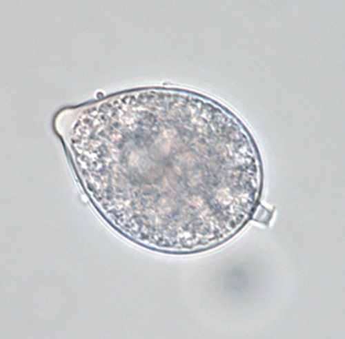   Phytophthora hedriandra  (CPHST BL 4) asexual phase of the ex-type: sporangium papillate with caducous short pedicel; photos by Gloria Abad USDA-APHIS-PPQ. 
