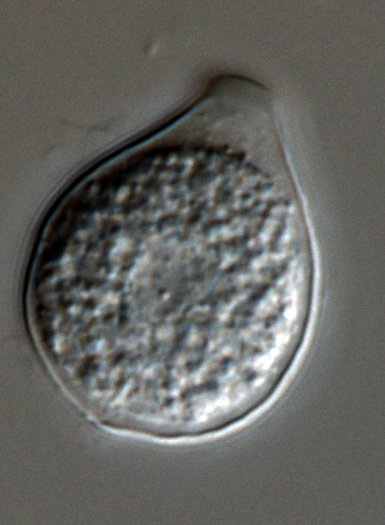   Phytophthora heveae nbsp;(P10167, selected specimen) asexual phase:nbsp;papillate sporangium; photonbsp;by Gloria Abad, USDA-APHIS-PPQ. 
