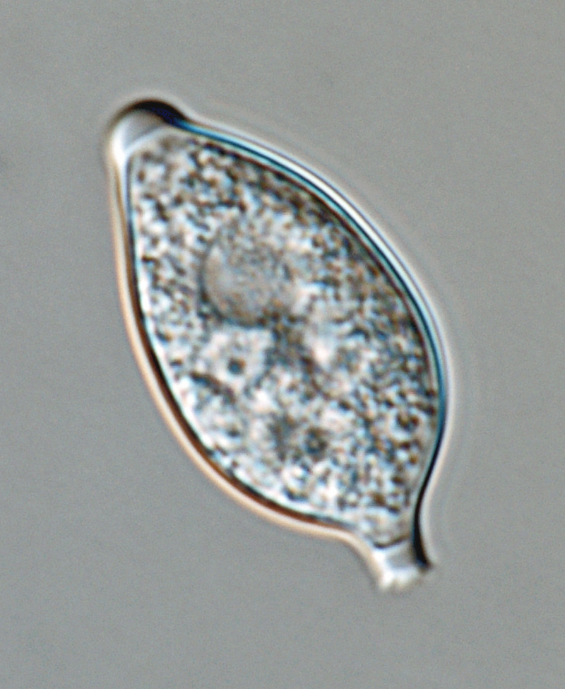   Phytophthora infestans nbsp;(CPHST BL 142, selected specimen) asexual phase: semipapillatenbsp;caducousnbsp;sporangium with short pedicel;nbsp;photo by Gloria Abad, USDA-APHIS. 
