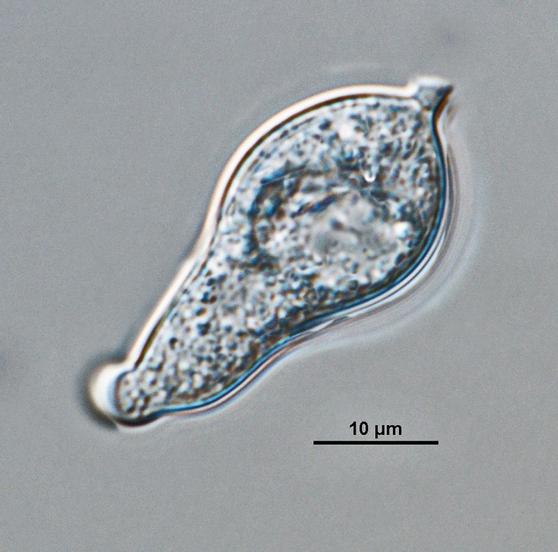   Phytophthora infestans nbsp;(CPHST BL 142, selected specimen) asexual phase: semipapillatenbsp;caducousnbsp;sporangium with short pedicel;nbsp;photo by Gloria Abad, USDA-APHIS. 

