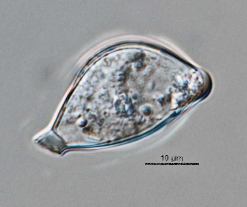  Phytophthora infestans nbsp;(CPHST BL 142, selected specimen) asexual phase: semipapillatenbsp;caducousnbsp;sporangium with short pedicel;nbsp;photo by Gloria Abad, USDA-APHIS. 
