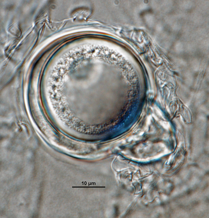   Phytophthora iranica nbsp;(ex-type CPHST BL 40) sexual phase:nbsp;oogoniumnbsp;smooth-walled and oosporenbsp;aplerotic; sometimesnbsp;amphyginousnbsp;antheridium; photos by Gloria Abad, USDA-APHIS-PPQ. 

