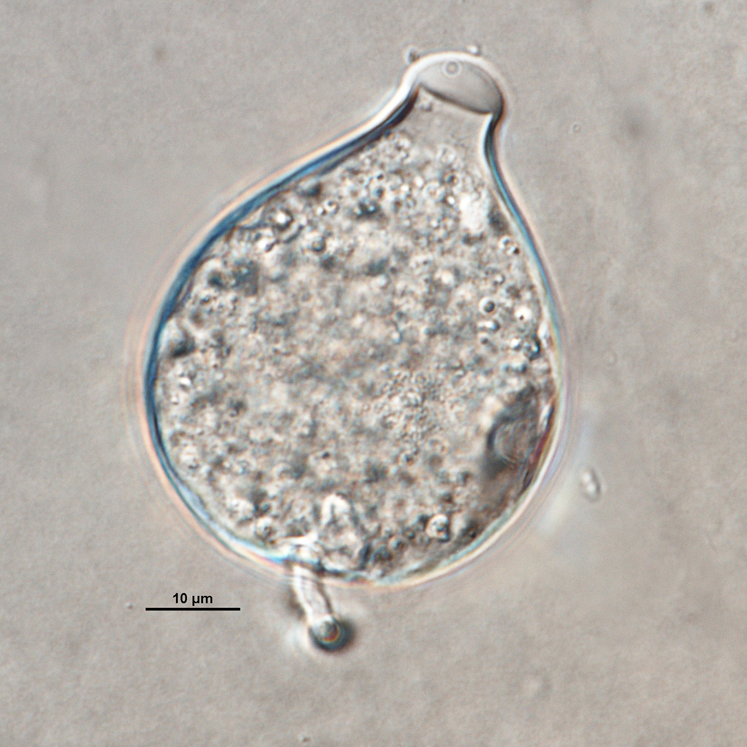   Phytophthora iranicanbsp; (ex-type CPHST BL 40) asexual phase: papillate caducuos sporangium; photonbsp;by Gloria Abad, USDA-APHIS-PPQ. 
