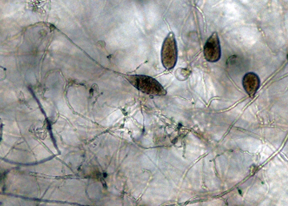   Phytophthora iranicanbsp; (ex-type CPHST BL 40) asexual phase:nbsp;sporangia papillate, mostly persistent but sometimes caducous; photonbsp;by Gloria Abad, USDA-APHIS-PPQ. 
