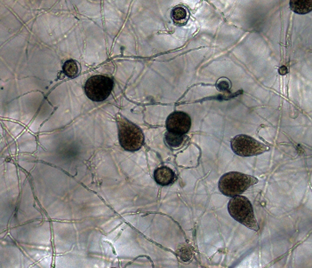   Phytophthora iranicanbsp; (ex-type CPHST BL 40) asexual phase:nbsp;sporangia papillate, mostly persistent but sometimes caducous; photonbsp;by Gloria Abad, USDA-APHIS-PPQ. 
