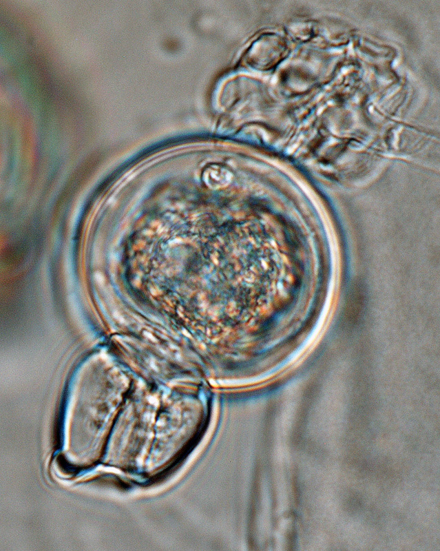   Phytophthora iranica nbsp;(ex-type CPHST BL 40) sexual phase:nbsp;oogoniumnbsp;smooth-walled and oosporenbsp;aplerotic; sometimesnbsp;amphyginousnbsp;antheridium; photos by Gloria Abad, USDA-APHIS-PPQ. 
