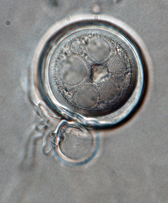   Phytophthora iranica  (ex-type CPHST BL 40) sexual phase: oogonium smooth-walled and oospore aplerotic; antheridium predominantly paragynous; photo by Gloria Abad, USDA-APHIS-PPQ. 

