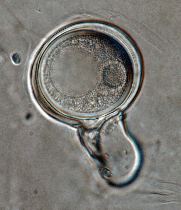   Phytophthora iranica  (ex-type CPHST BL 40) sexual phase: oogonium smooth-walled and oospore aplerotic; antheridium predominantly paragynous; photo by Gloria Abad, USDA-APHIS-PPQ. 
