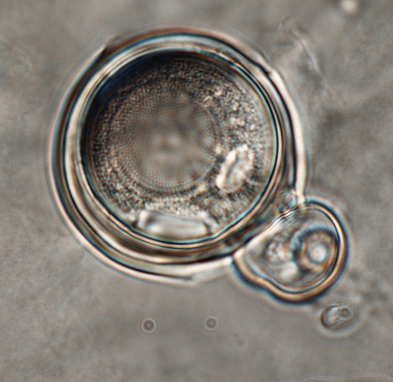   Phytophthora iranica  (ex-type CPHST BL 40) sexual phase: oogonium smooth-walled and oospore aplerotic; antheridium predominantly paragynous; photo by Gloria Abad, USDA-APHIS-PPQ. 
