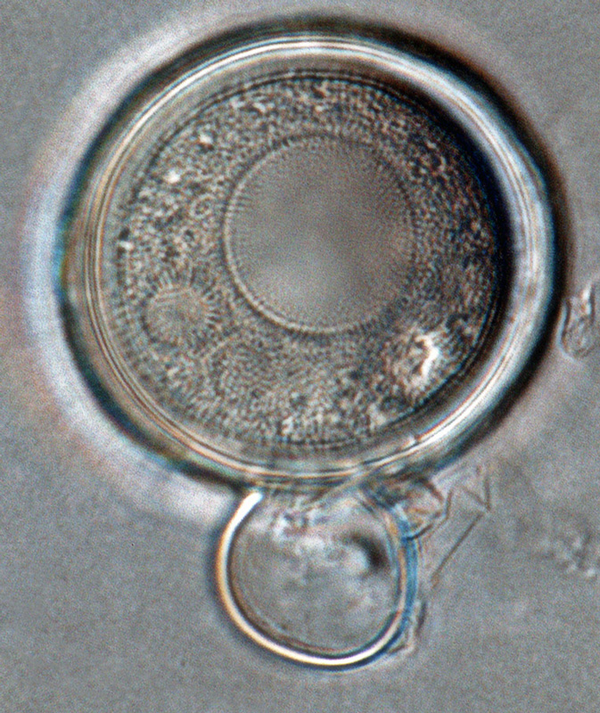   Phytophthora iranica  (ex-type CPHST BL 40) sexual phase: oogonium smooth-walled and oospore aplerotic; antheridium predominantly paragynous; photo by Gloria Abad, USDA-APHIS-PPQ. 
