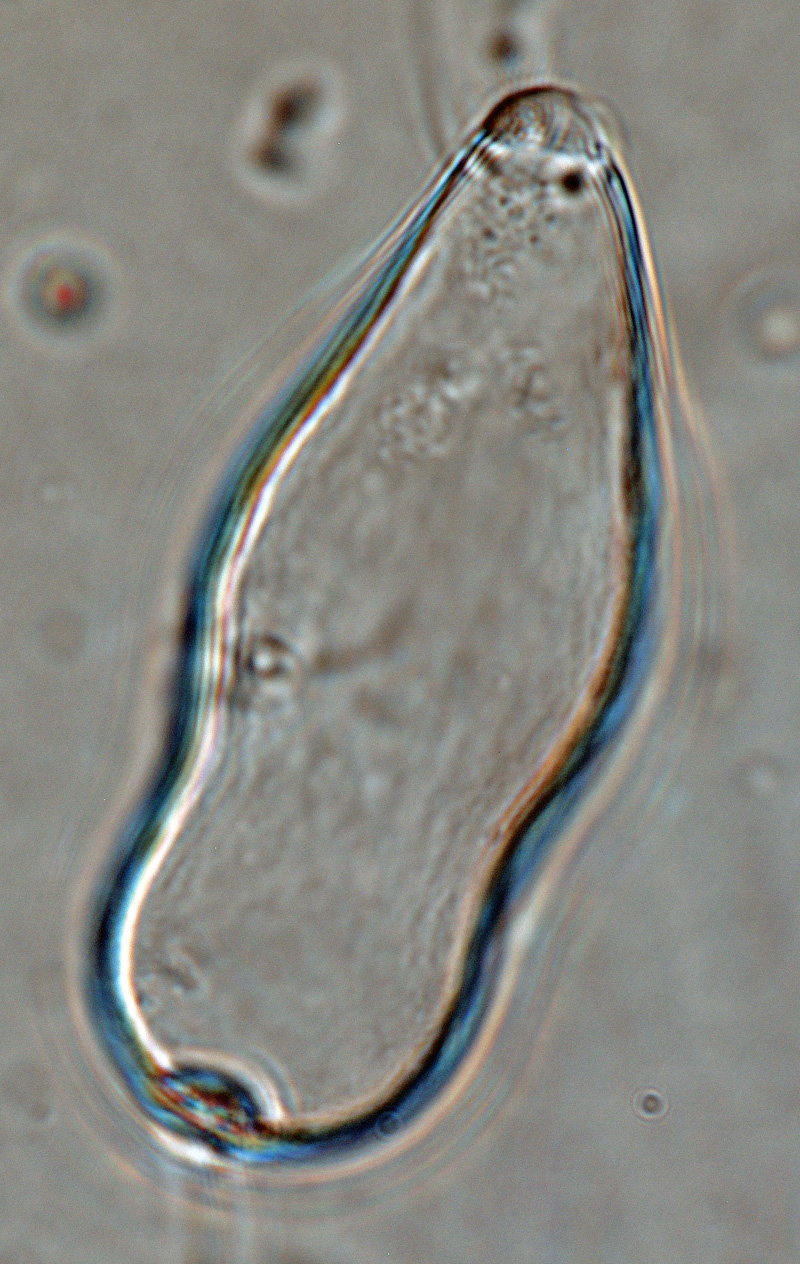   Phytophthora iranicanbsp; (ex-type CPHST BL 40) asexual phase:nbsp;papillatenbsp;caducuos sporangium; photonbsp;by Gloria Abad, USDA-APHIS-PPQ. 
