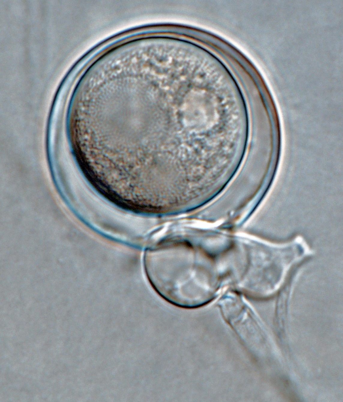   Phytophthora lilii nbsp;(ex-type CPHST BL 123 = CBS 135746) sexual phase:nbsp;smooth-walled oogonia with aplerotic oospore withnbsp;paragynous antheridium;nbsp;photonbsp;by Gloria Abad, USDA-APHIS-PPQ. 

