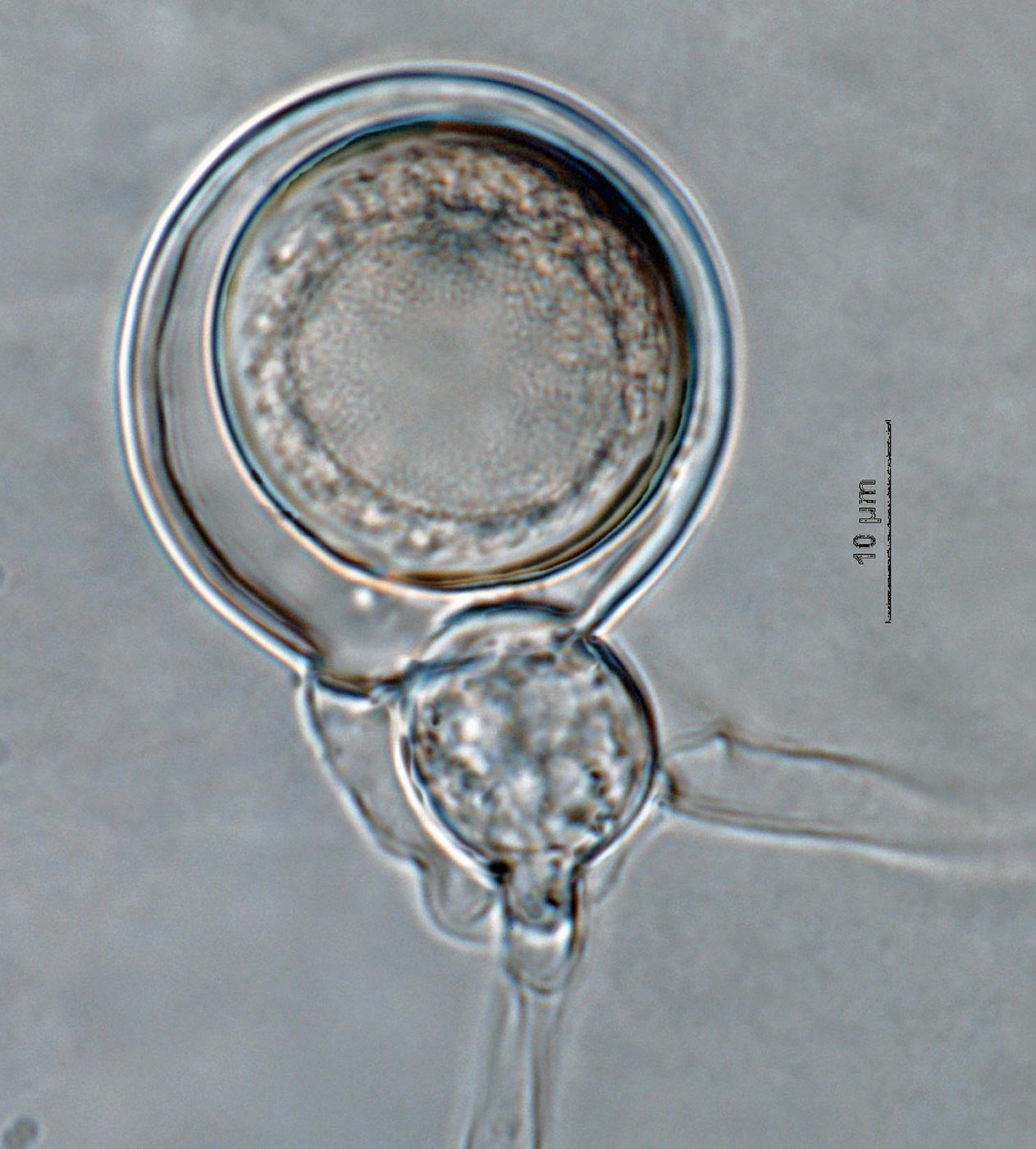   Phytophthora lilii nbsp;(ex-type CPHST BL 123 = CBS 135746) sexual phase:nbsp;smooth-walled oogonia with aplerotic oospore with paragynous antheridium; photonbsp;by Gloria Abad, USDA-APHIS-PPQ. 
