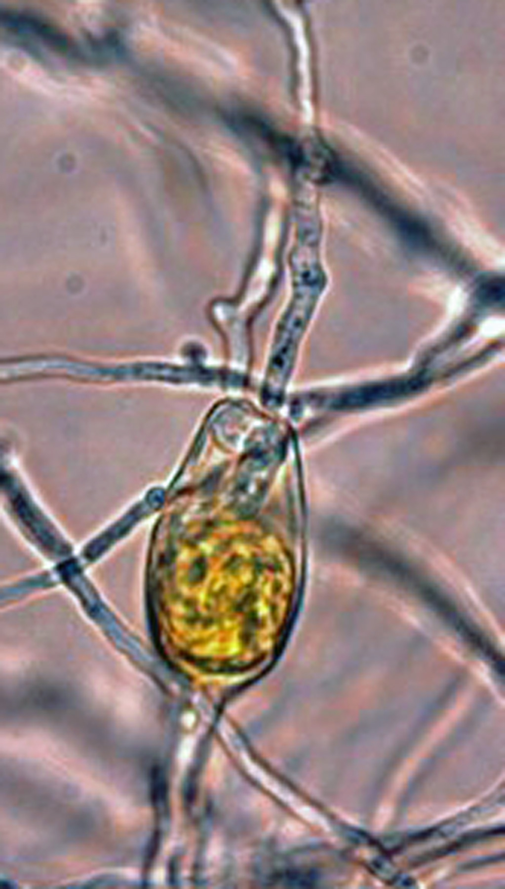   Phytophthora lilii nbsp;(ex-type CBS 135746) asexual phase:nbsp;internal proliferation ofnbsp;sporangium; photos by Koji Kageyama and Mohammad Z. Rahman Gifu University, Japan. 
